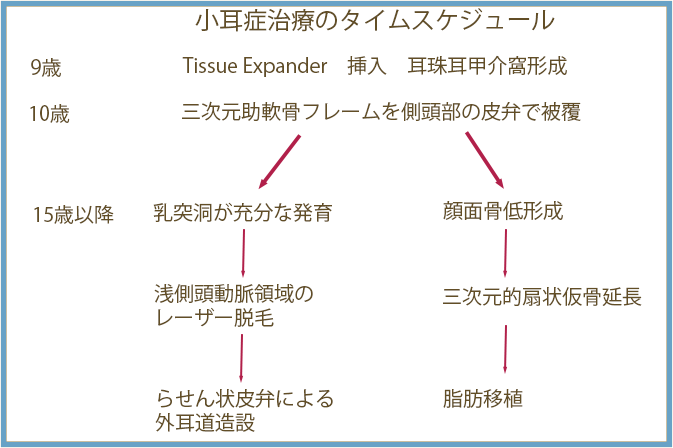 小耳症治療のタイムスケジュール