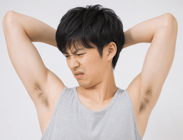 わきが・腋臭症のイメージ